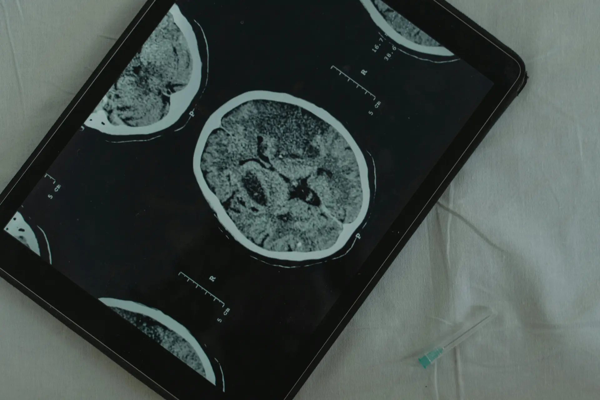 Brain scan on a tablet.